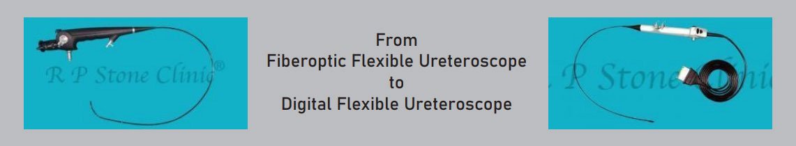 Flexible Ureteroscopy